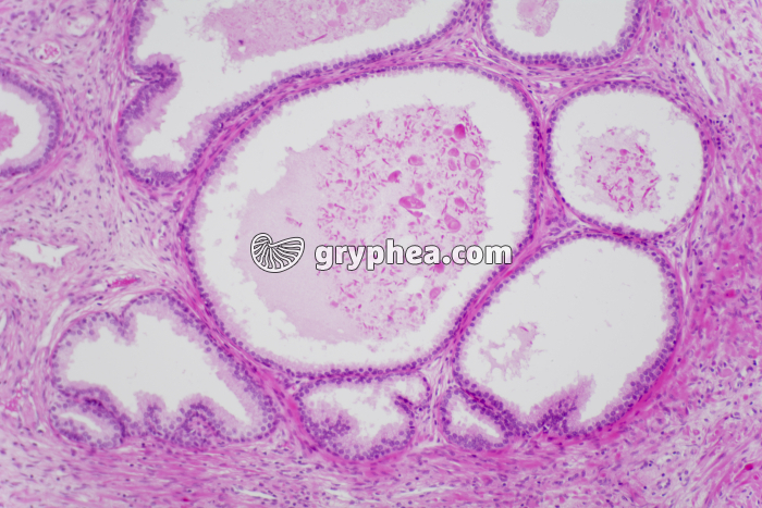 Prostate x40 - gryphea.com